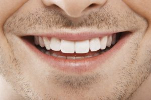 dentes